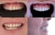 Slider image (6) Dentleon Polyclinics